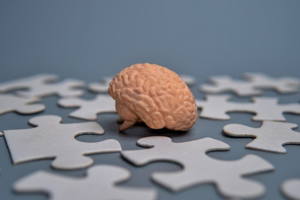 Model of a human brain surrounded by scattered puzzle pieces.